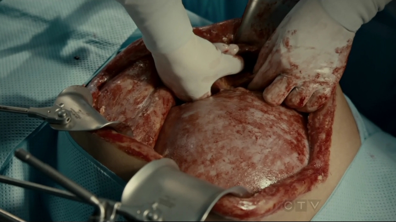 VampireDiariesWorld-dot-org_SavingHope2x10-0564.jpg
