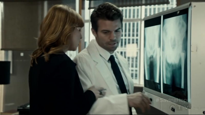VampireDiariesWorld-dot-org_SavingHope2x12-0400.jpg