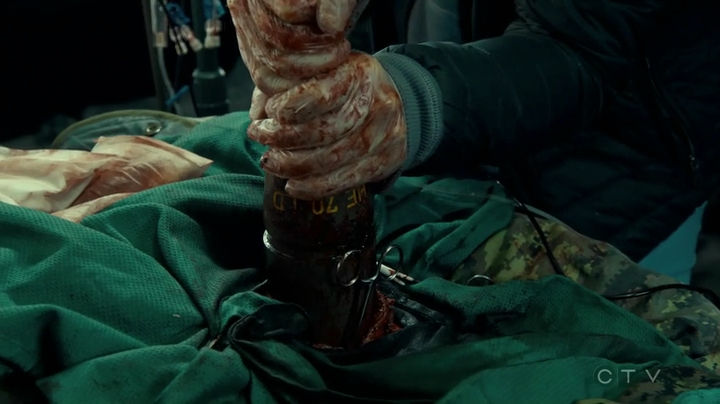 VampireDiariesWorld_dot_nl-SavingHope3x18-1966.jpg VampireDiariesWorld_dot_nl-SavingHope3x18-1966.jpg